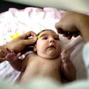 Bé 4 tháng tuổi ở Đắk Lắk nghi bị chứng đầu nhỏ do virus Zika