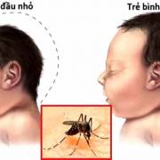 Bình Dương công bố dịch Zika quy mô phường, xã