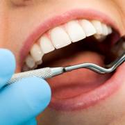 Bệnh răng miệng làm tăng nguy cơ ung thư ở phụ nữ lớn tuổi