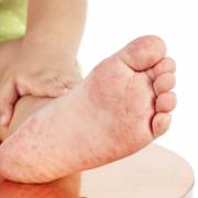 BS Trần Thị Huyên Thảo: 7 câu hỏi cần làm rõ về bệnh tay chân miệng