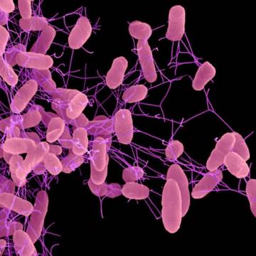 Hiểm hoạ dịch siêu khuẩn toàn kháng từ Trung Quốc