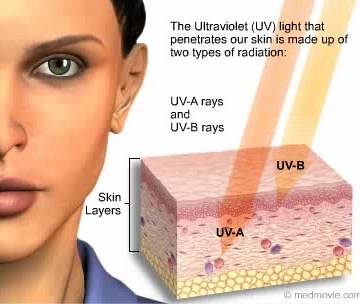 Cách phòng ngừa tia cực tím gây tổn thương da