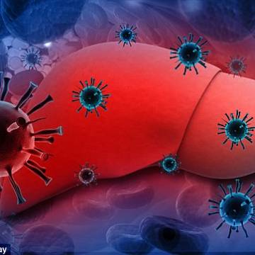 Viêm gan siêu vi gây tử vong nhiều hơn HIV, lao và sốt rét