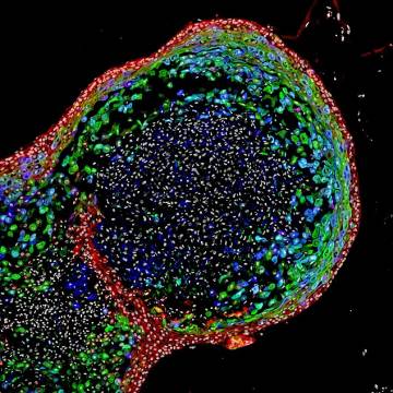 Chế tạo thực quản tế bào gốc để nghiên cứu bệnh