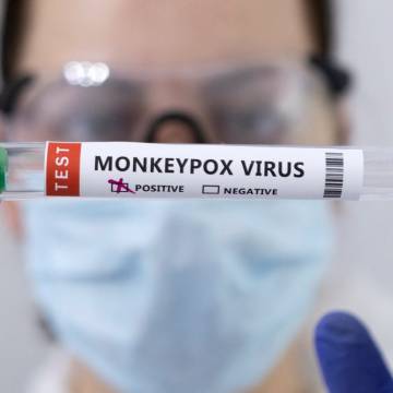 WHO: Có thể không cần tiêm chủng diện rộng với bệnh đậu mùa khỉ